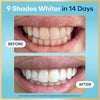 Enamel-Safe & Peroxide-Free Teeth Whitening Strips, Dentist Formulated, 14-Pack