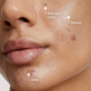 Evenly Clear Acne Cleansing Mask, 4.2 fl. oz