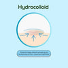 Extra Strength Blemish Patch with Salicylic Acid and Hydrocolloid, Latex-Free, Acne Treatment for All Skin Types, 36 Ct.