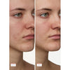 Super Fade Serum with Niacinamide and Tranexamic Acid, 1 fl oz